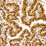 DDX1 Antibody in Immunohistochemistry (Paraffin) (IHC (P))