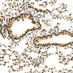 DDX1 Antibody in Immunohistochemistry (Paraffin) (IHC (P))