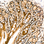 DDX1 Antibody in Immunohistochemistry (Paraffin) (IHC (P))