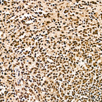 DDX1 Antibody in Immunohistochemistry (Paraffin) (IHC (P))