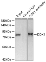 DDX1 Antibody in Immunoprecipitation (IP)
