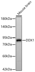 DDX1 Antibody in Western Blot (WB)