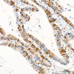 CDK1/CDK2 Antibody in Immunohistochemistry (Paraffin) (IHC (P))