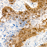 CDK1/CDK2 Antibody in Immunohistochemistry (Paraffin) (IHC (P))