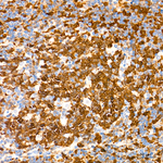 CDK1/CDK2 Antibody in Immunohistochemistry (Paraffin) (IHC (P))