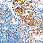 CDK1/CDK2 Antibody in Immunohistochemistry (Paraffin) (IHC (P))
