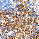 CDK1/CDK2 Antibody in Immunohistochemistry (Paraffin) (IHC (P))