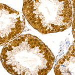 CDK1/CDK2 Antibody in Immunohistochemistry (Paraffin) (IHC (P))