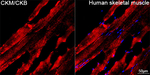 Creatine Kinase MB Antibody in Immunohistochemistry (Paraffin) (IHC (P))