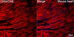 Creatine Kinase MB Antibody in Immunohistochemistry (Paraffin) (IHC (P))
