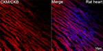 Creatine Kinase MB Antibody in Immunohistochemistry (Paraffin) (IHC (P))