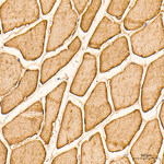 Creatine Kinase MB Antibody in Immunohistochemistry (Paraffin) (IHC (P))
