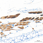 Creatine Kinase MB Antibody in Immunohistochemistry (Paraffin) (IHC (P))