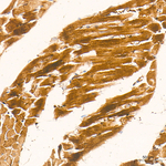 Creatine Kinase MB Antibody in Immunohistochemistry (Paraffin) (IHC (P))