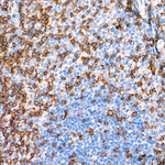CD2 Recombinant Rabbit Monoclonal Antibody (3A9B3)