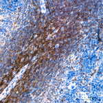 CD2 Antibody in Immunohistochemistry (Paraffin) (IHC (P))