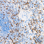 CD2 Antibody in Immunohistochemistry (Paraffin) (IHC (P))
