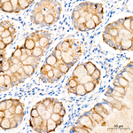 IL-12 p40 Recombinant Rabbit Monoclonal Antibody (3J8O0)