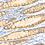 IL-12 p40 Antibody in Immunohistochemistry (Paraffin) (IHC (P))