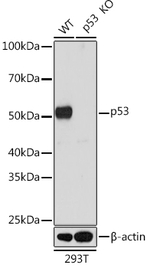 p53 Recombinant Rabbit Monoclonal Antibody (9L6E2)