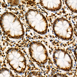 H4K12ac Antibody in Immunohistochemistry (Paraffin) (IHC (P))