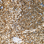 H4K12ac Recombinant Rabbit Monoclonal Antibody (6H8U8)