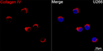 Collagen IV Recombinant Rabbit Monoclonal Antibody (3K8C2)