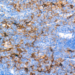 CD80 Antibody in Immunohistochemistry (Paraffin) (IHC (P))
