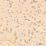 RIP3 Antibody in Immunohistochemistry (Paraffin) (IHC (P))
