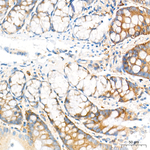 RIP3 Antibody in Immunohistochemistry (Paraffin) (IHC (P))