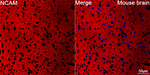 CD56 Antibody in Immunohistochemistry (Paraffin) (IHC (P))