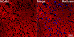 CD56 Antibody in Immunohistochemistry (Paraffin) (IHC (P))