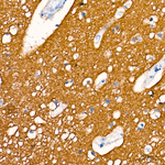 CD56 Antibody in Immunohistochemistry (Paraffin) (IHC (P))