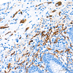 CD56 Antibody in Immunohistochemistry (Paraffin) (IHC (P))
