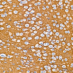 CD56 Antibody in Immunohistochemistry (Paraffin) (IHC (P))
