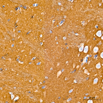 CD56 Antibody in Immunohistochemistry (Paraffin) (IHC (P))
