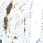 CD56 Antibody in Immunohistochemistry (Paraffin) (IHC (P))