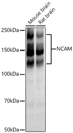 CD56 Antibody in Western Blot (WB)