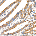 SEL1L Recombinant Rabbit Monoclonal Antibody (0U4J8)