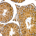 SEL1L Antibody in Immunohistochemistry (Paraffin) (IHC (P))