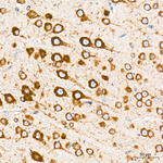 SEL1L Antibody in Immunohistochemistry (Paraffin) (IHC (P))