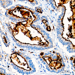 CD66a Antibody in Immunohistochemistry (Paraffin) (IHC (P))