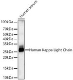 Kappa Light Chain Antibody in Western Blot (WB)