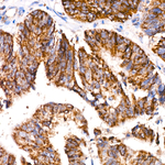 ACAT1 Antibody in Immunohistochemistry (Paraffin) (IHC (P))