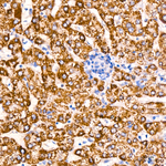 ACAT1 Antibody in Immunohistochemistry (Paraffin) (IHC (P))