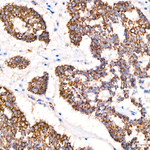 ACAT1 Antibody in Immunohistochemistry (Paraffin) (IHC (P))