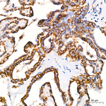 ACAT1 Antibody in Immunohistochemistry (Paraffin) (IHC (P))