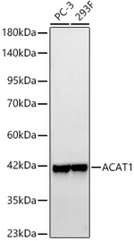 ACAT1 Antibody in Western Blot (WB)