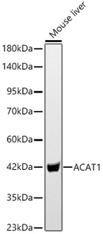ACAT1 Antibody in Western Blot (WB)