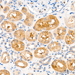 MLKL Antibody in Immunohistochemistry (Paraffin) (IHC (P))